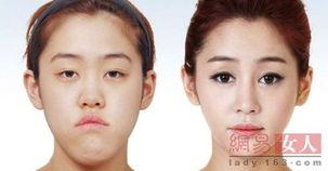 微整图片对比照片,揭秘美丽蜕变之旅